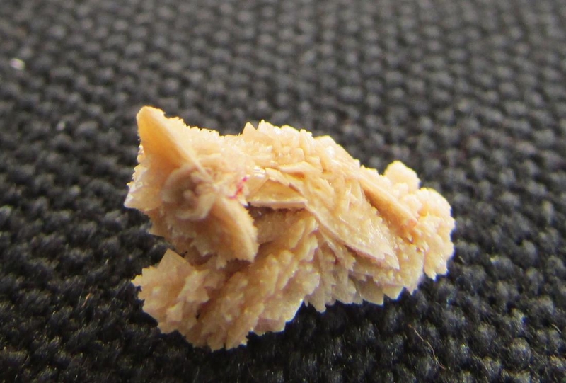 Giải mã sự hình thành sỏi thận và nguyên nhân gây bệnh sỏi thận 2