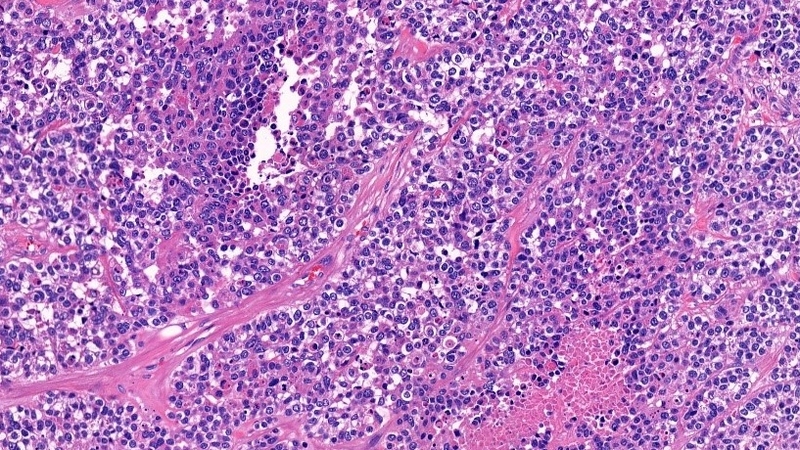 Giải phẫu bệnh có vai trò gì 2