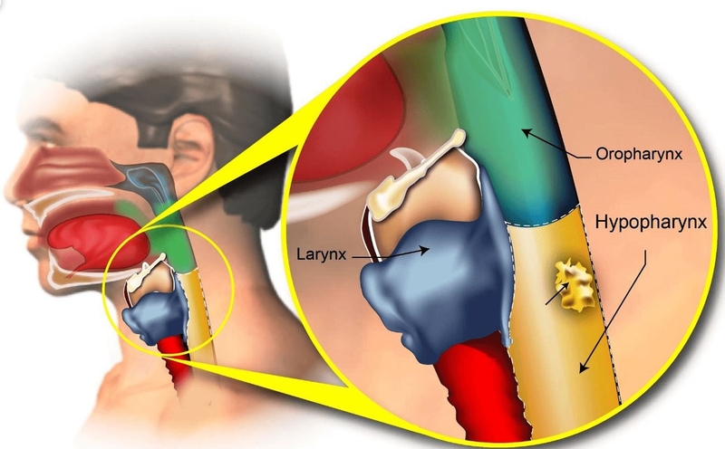 Giải phẫu hạ họng và các ứng dụng trong ung thư hạ họng 3