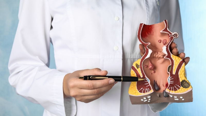 Đau, ngứa, chảy máu khi đi đại tiện,... là những triệu chứng phổ biến cảnh báo các vấn đề về hậu môn