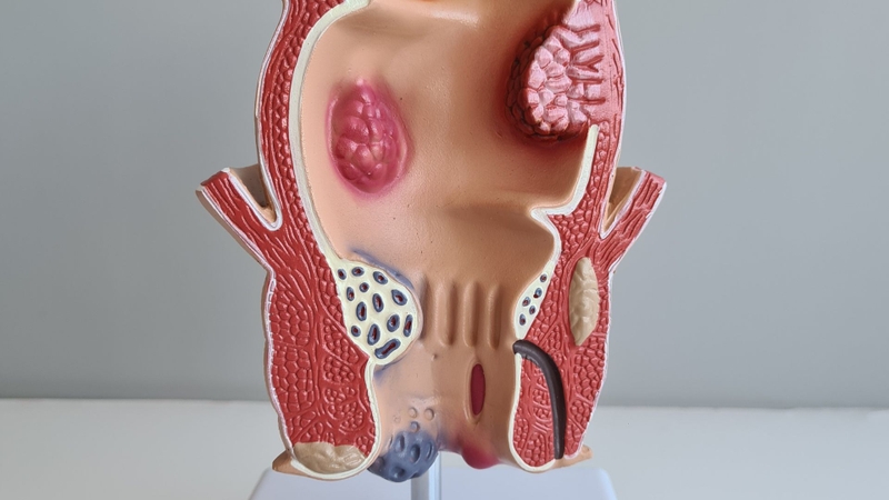 Hậu môn đóng vai trò quan trọng trong quá trình bài tiết và kiểm soát chất thải ra khỏi cơ thể