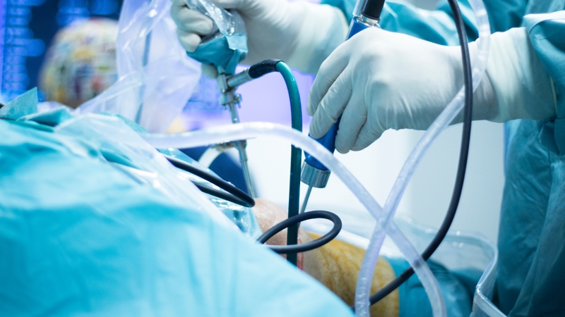 Nội soi khớp là kỹ thuật đưa một thiết bị nhỏ vào trong khớp để quan sát trực tiếp cấu trúc bên trong