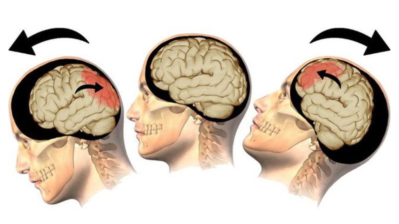 Giải phẫu xương trên khuôn mặt - xương mặt 4