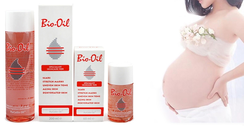 Giải quyết nổi lo rạn da sau sinh bằng những loại thuốc công hiệu