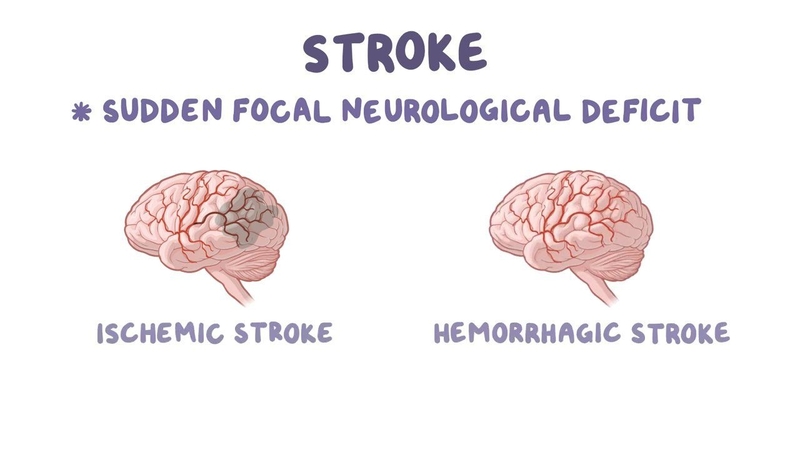 Giải đáp: Vì sao hút thuốc lá gây đột quỵ? 1