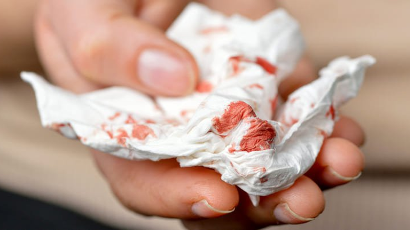 Giảm ho lao một cách hiệu quả - Cách hỗ trợ điều trị đơn giản tại nhà 2