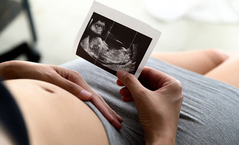 Giãn bể lớn hố sau ở thai nhi là gì? Nguyên nhân gây giãn bể lớn hố sau ở thai nhi 1