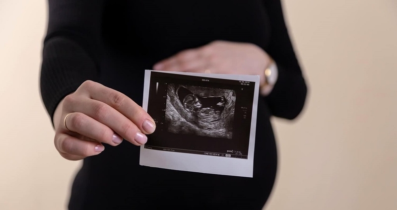 Giãn bể lớn hố sau ở thai nhi là gì? Nguyên nhân gây giãn bể lớn hố sau ở thai nhi 3