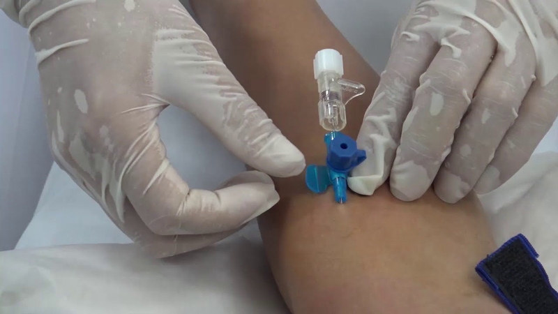 gian-co-sau-la-gi-va-mot-so-thong-tin-lien-quan-ve-gian-co-sau 3.jpg