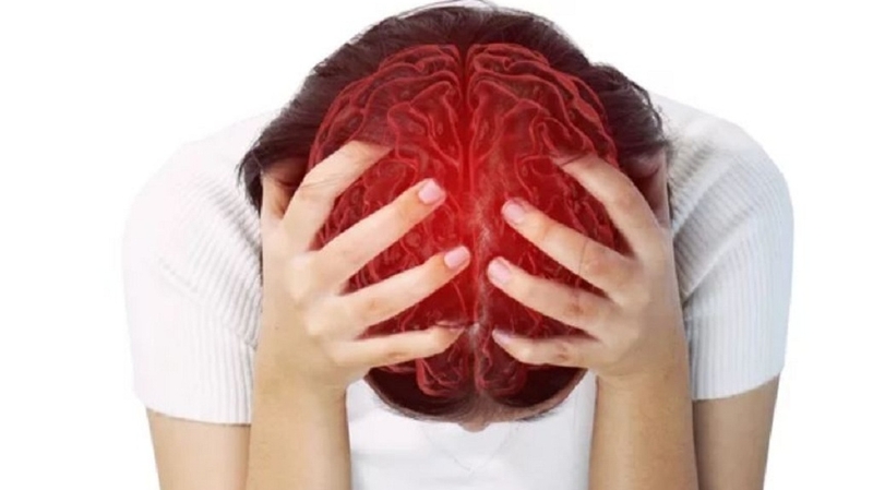 Giãn mạch máu não: Triệu chứng, điều trị và cách phòng ngừa 1