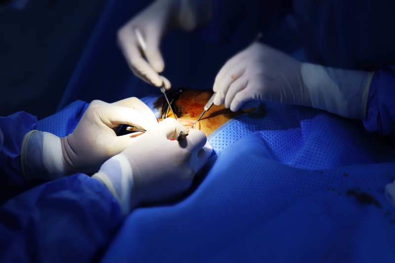 gian-mao-mach-xuat-huyet-di-truyen-nhung-dieu-can-biet 3.jpg