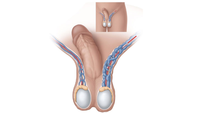 gian-tinh-mach-thung-tinh-co-nguy-hiem-khong (1).png