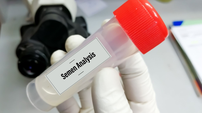 Bác sĩ có thể chỉ định làm xét nghiệm tinh dịch đồ để hỗ trợ chẩn đoán