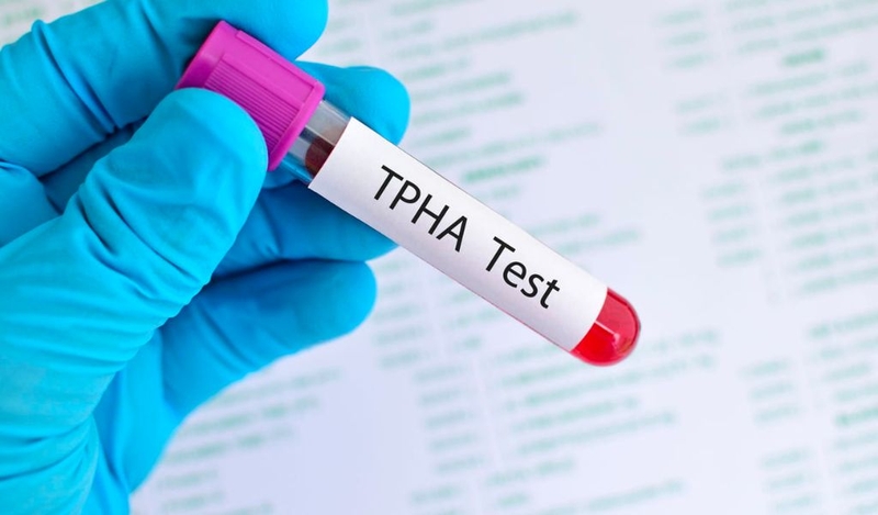 Giang mai kín là gì và các giai đoạn phát triển bệnh? 2