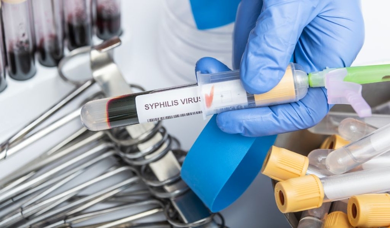 Giang mai kín là gì và các giai đoạn phát triển bệnh? 3