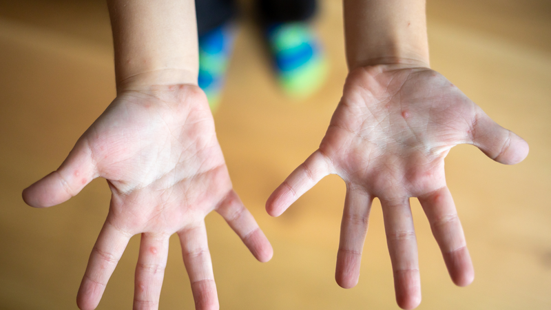 Có dấu hiệu cảnh báo, nên đưa trẻ đi khám sớm