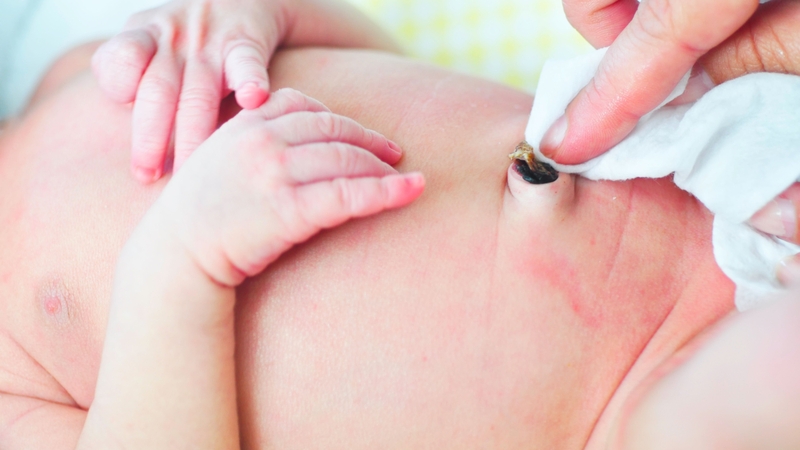Giữ cuống rốn để làm gì? Những lưu ý cần biết 4