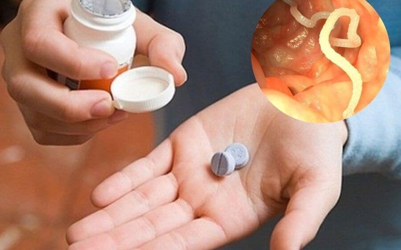 Giun móc tên khoa học là gì? Những điều cần biết về bệnh giun móc 4