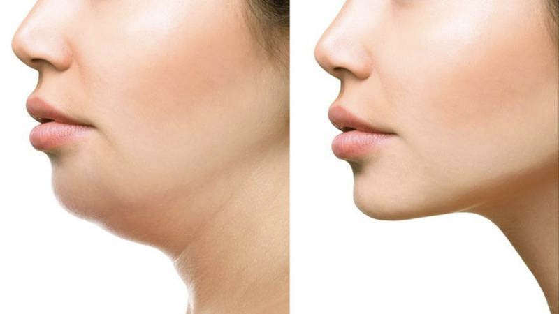 [Góc hỏi đáp]  Tập mewing bao nhiêu phút một ngày là hợp lý? 1