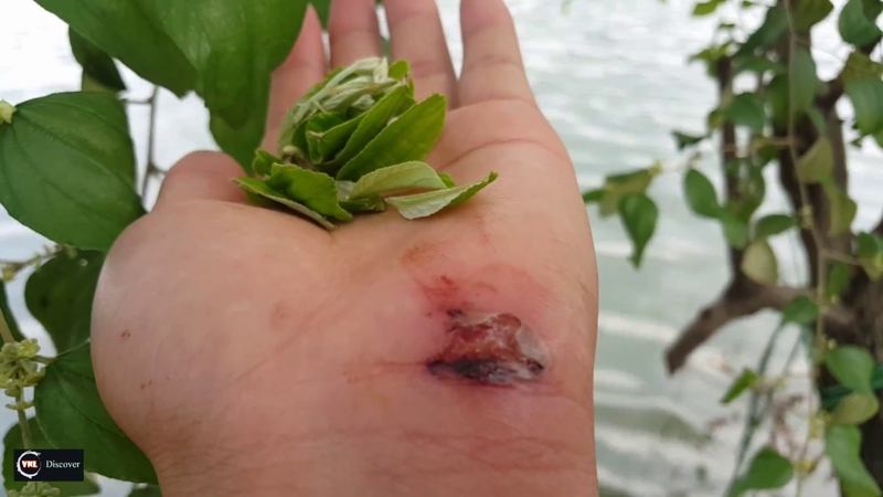 Giúp vết thương mau lành bằng hợp chất có trong thực vật 1