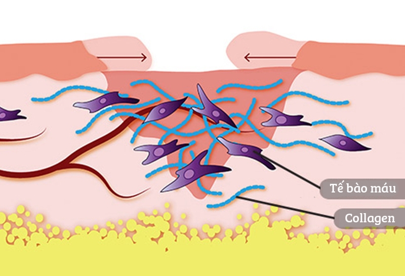Giúp vết thương mau lành bằng hợp chất có trong thực vật