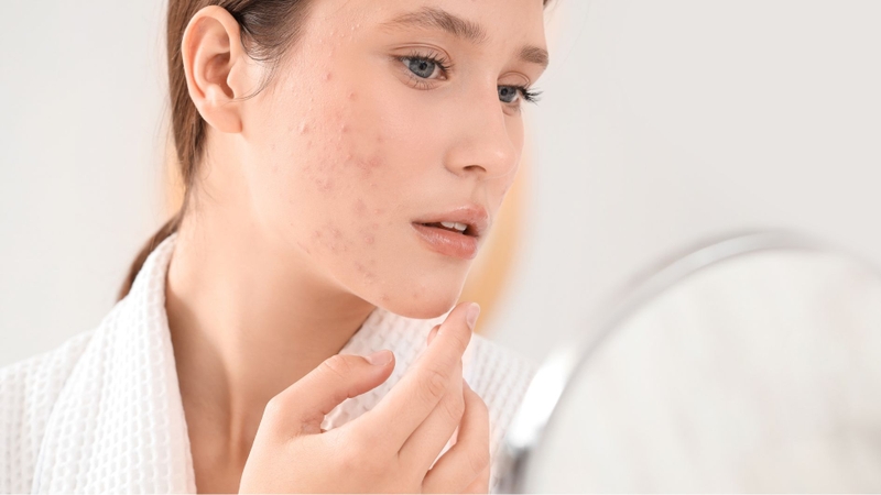 Gluconolactone vẫn có khả năng gây kích ứng da trong một số trường hợp