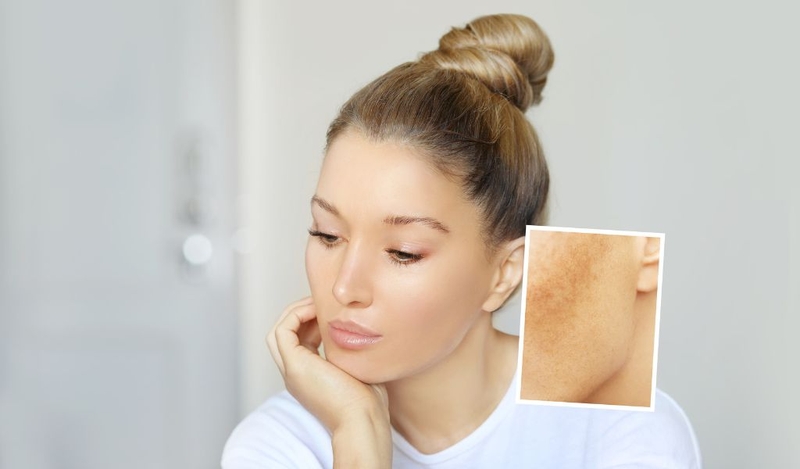 Glutathione white 800 giá bao nhiêu? Công dụng có thật sự hiệu quả? 3