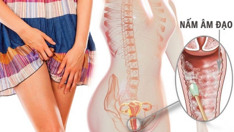 Góc bạn gái: Vệ sinh vùng kín và những điều nên biết 1