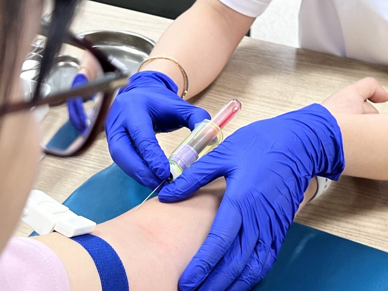 Góc giải đáp: Xét nghiệm PTT là gì? Những điều cần biết về xét nghiệm PTT 3