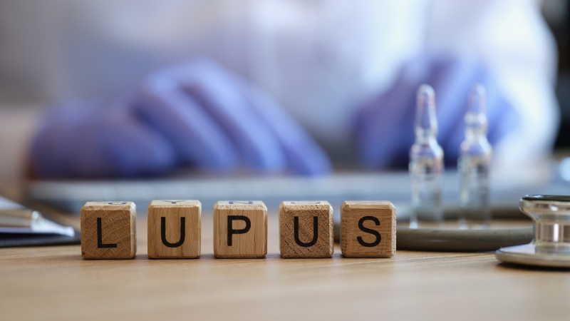 Bệnh lupus ban đỏ có lây không?