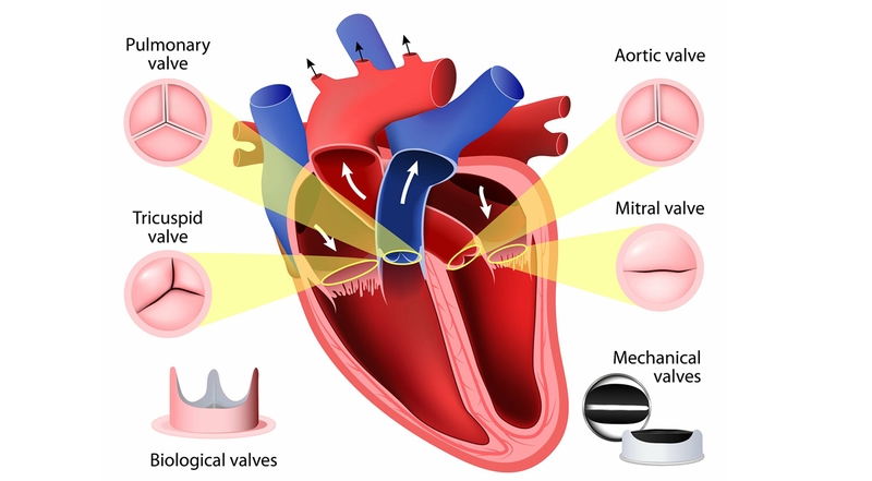 Góc giải đáp: Bị hở van tim có nguy hiểm không?