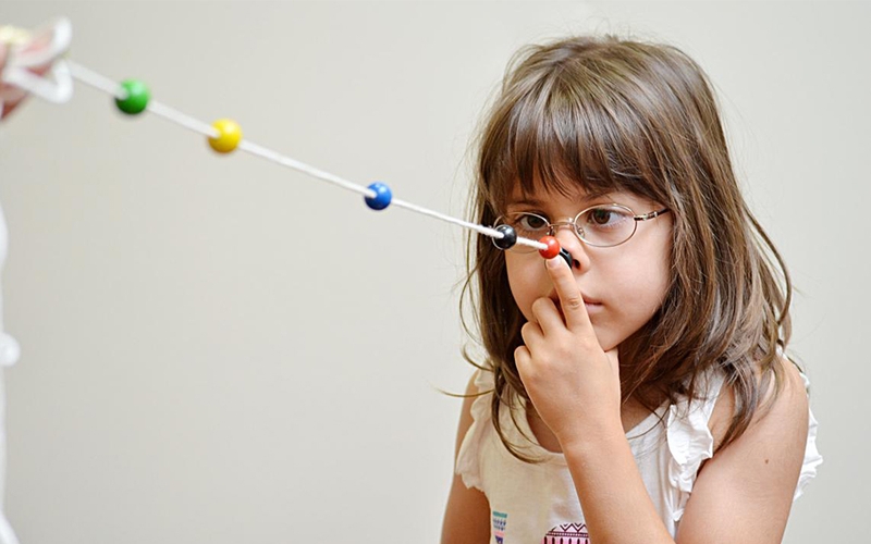 Góc giải đáp: Mắt lác có chữa được không? 4