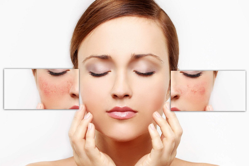 Góc giải đáp: Nên đắp mặt nạ bao lâu thì hiệu quả? 1