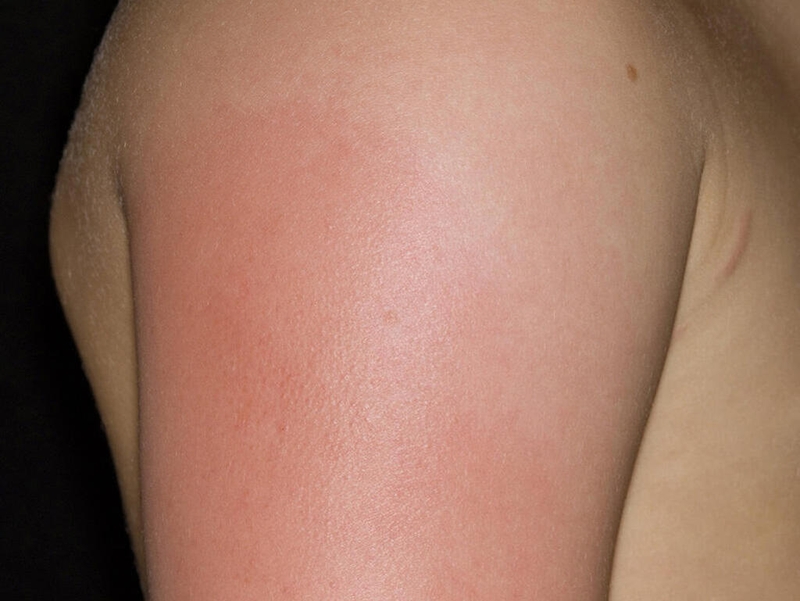 Góc giải đáp: Sau khi tiêm phòng cúm kiêng ăn gì để tốt cho sức khoẻ? 2