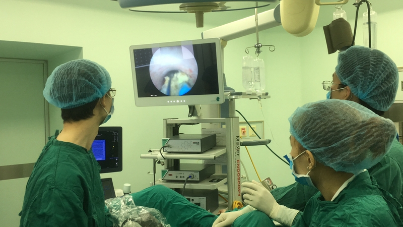 Góc giải đáp: Sỏi túi mật 22mm có phải mổ không? Vì sao? 4