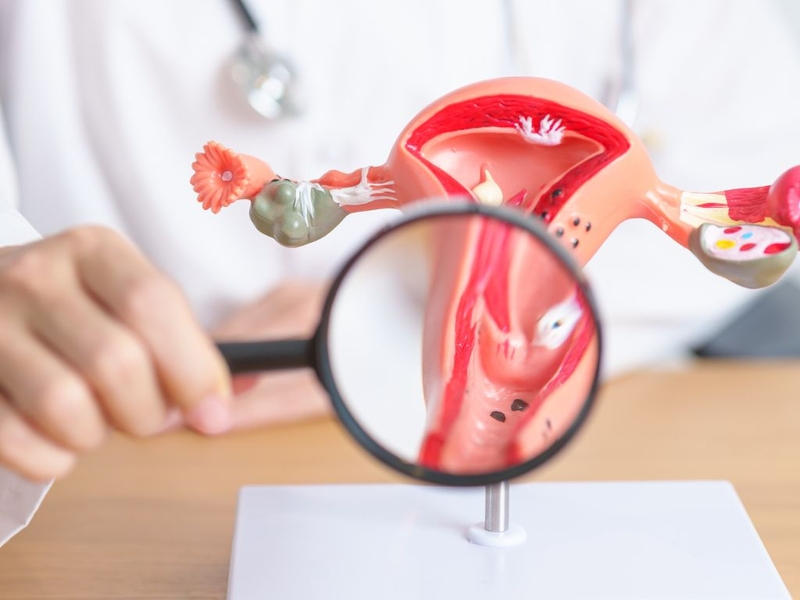 Góc giải đáp thắc mắc: Làm thế nào để kéo dài tuổi kinh nguyệt?  2