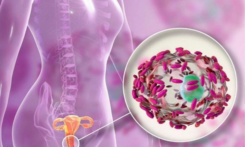 Góc giải đáp thắc mắc: Liệu ra khí hư màu trắng sữa có phải mang thai không? 3