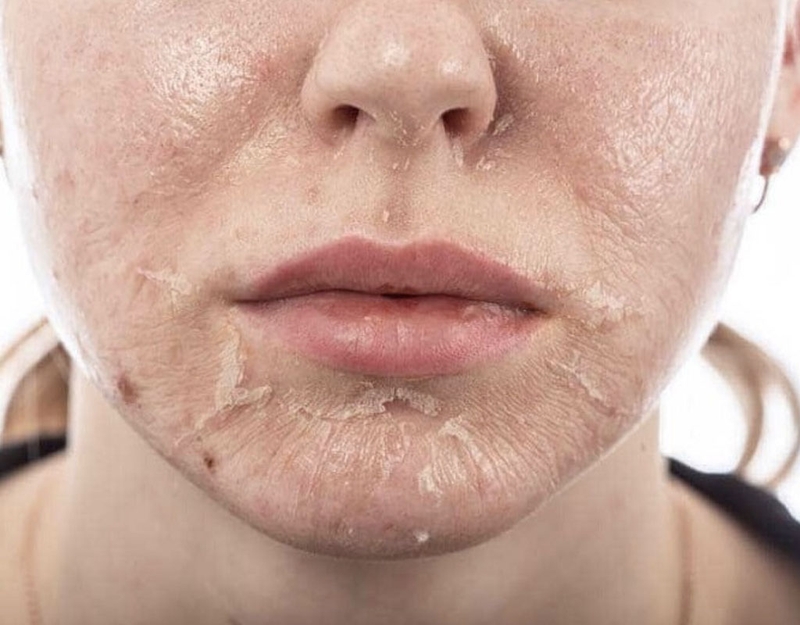 [Góc giải đáp] Thuốc Đông Y tái tạo da có tốt không? 1