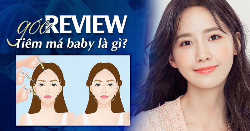 Góc giải đáp: Tiêm má baby là kỹ thuật gì? Review tiêm má baby