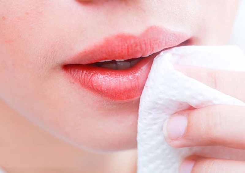 Góc giải đáp xăm môi bị chảy nước vàng có sao không và cách xử trí đúng4
