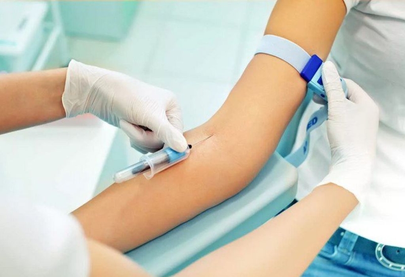 Góc giải đáp: Xét nghiệm lactate và những điều cần biết 3