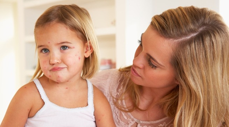 Góc hỏi đáp: Dị ứng hải sản có di truyền không? 2