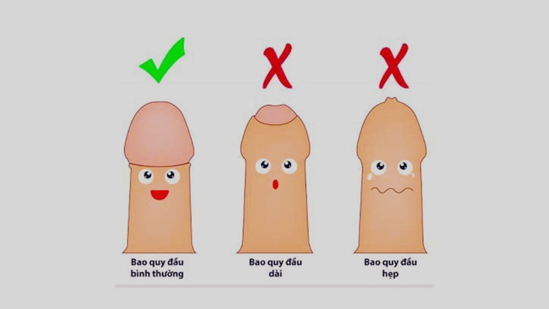 Góc sức khỏe: Nam giới 15 tuổi chưa lột bao quy đầu có sao không? 1