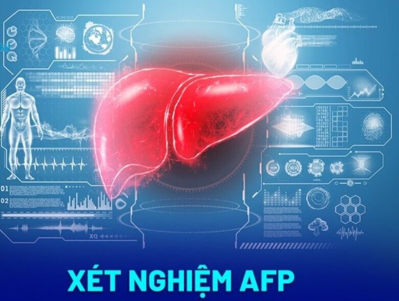 Góc sức khỏe: Những điều cần biết về chỉ số xét nghiệm marker ung thư 3