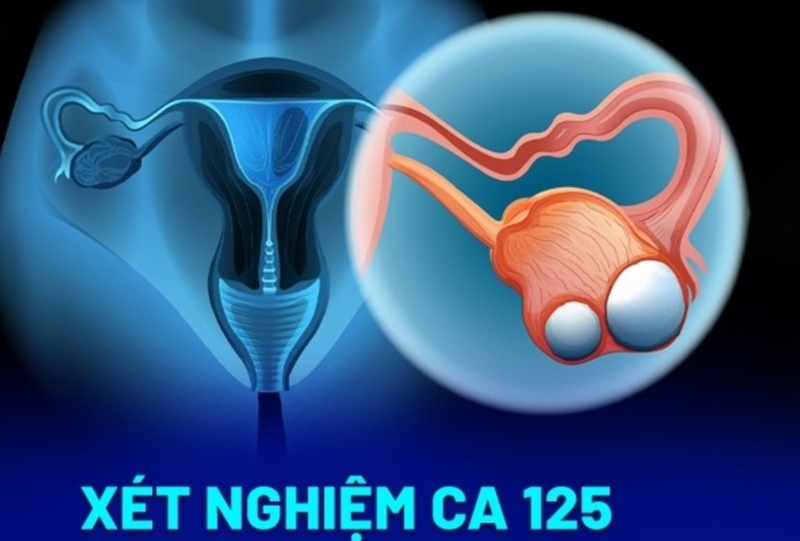 Góc sức khỏe: Những điều cần biết về chỉ số xét nghiệm marker ung thư 4