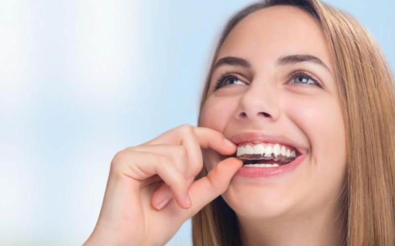 Niềng răng invisalign có hiệu quả không? Ưu và nhược điểm 2