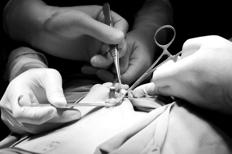 goc-thac-mac-phau-thuat-tinh-hoan-an-la-gi 1.jpg