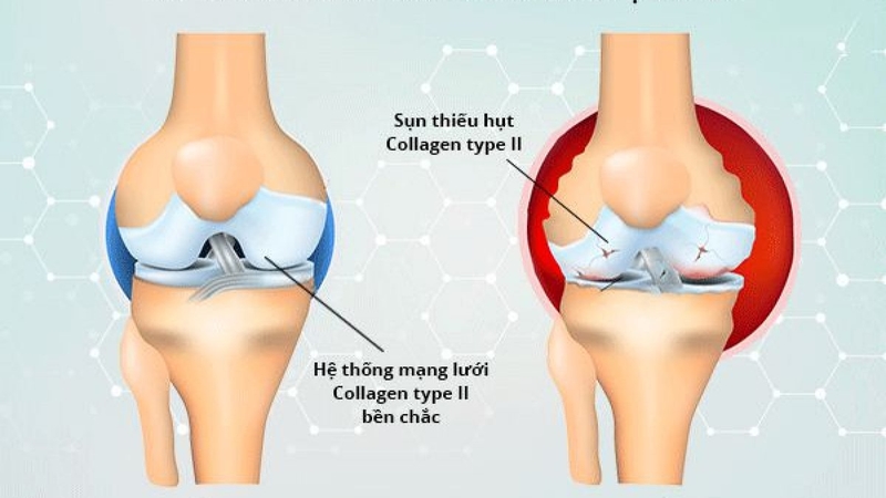 Góc tư vấn: Tuổi trung niên uống collagen loại nào tốt nhất 1
