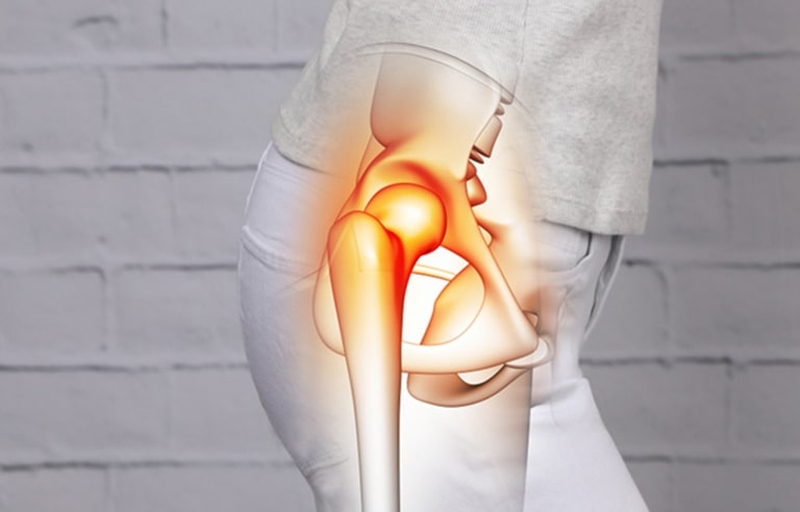 Đau khớp háng và đầu gối là gì? Nguyên nhân do đâu 2