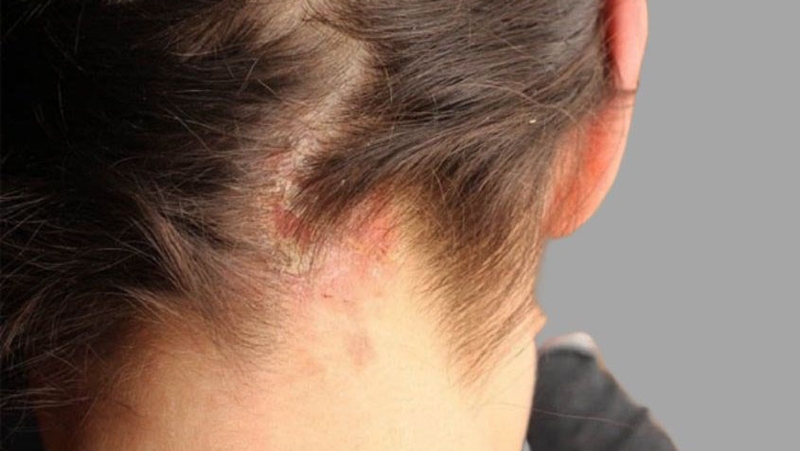 Gội đầu bằng bột giặt có sao không? Những điều cần biết để chăm sóc tóc khỏe mạnh 2